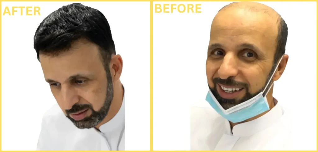Hair Fixing