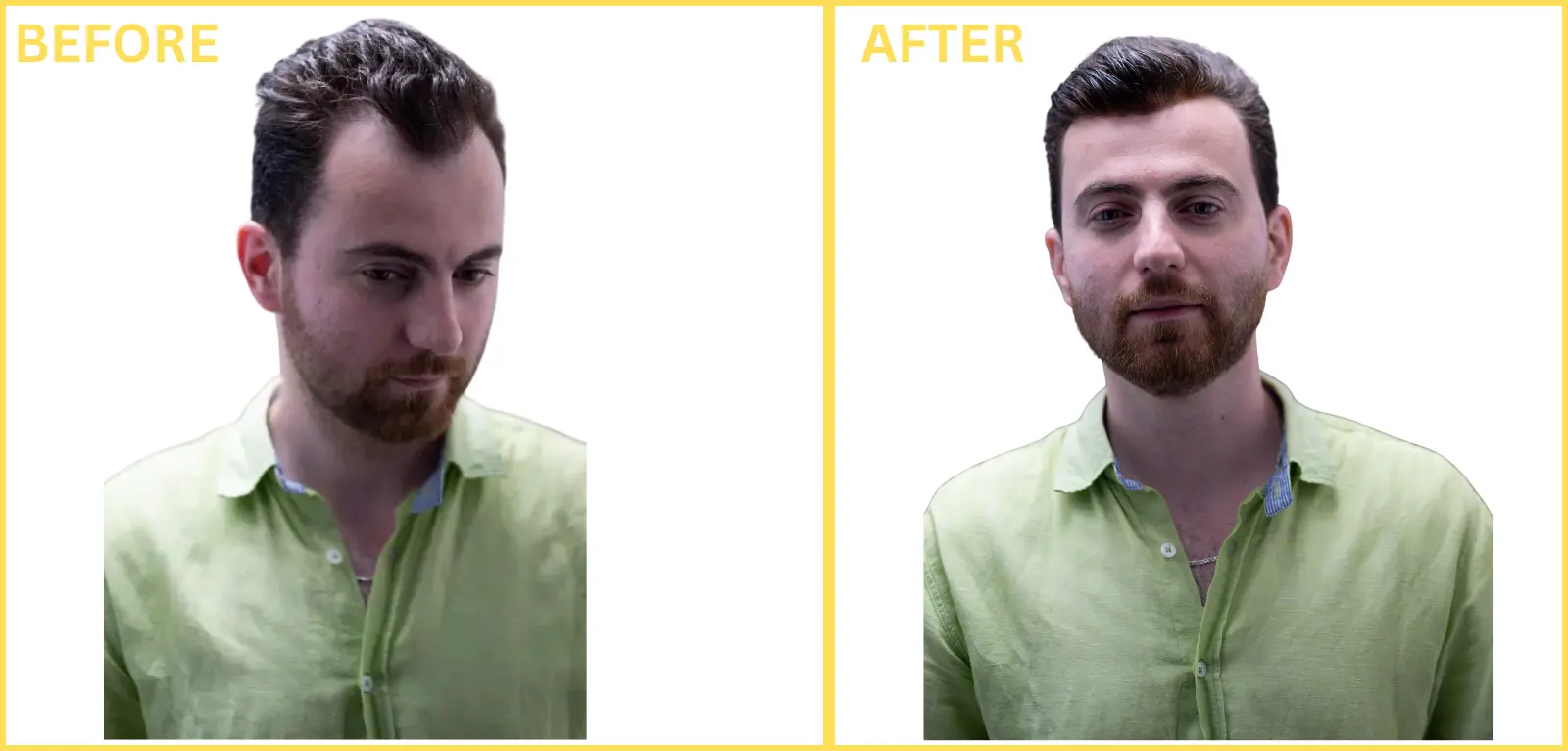 Front line Hair Fixing in Umm Al Quwain