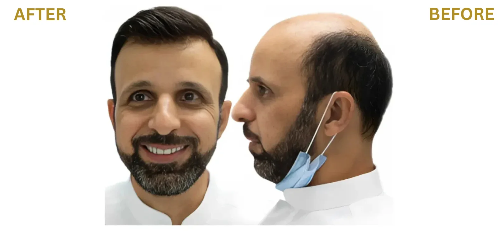 Hair Fixing in Umm Al Quwain