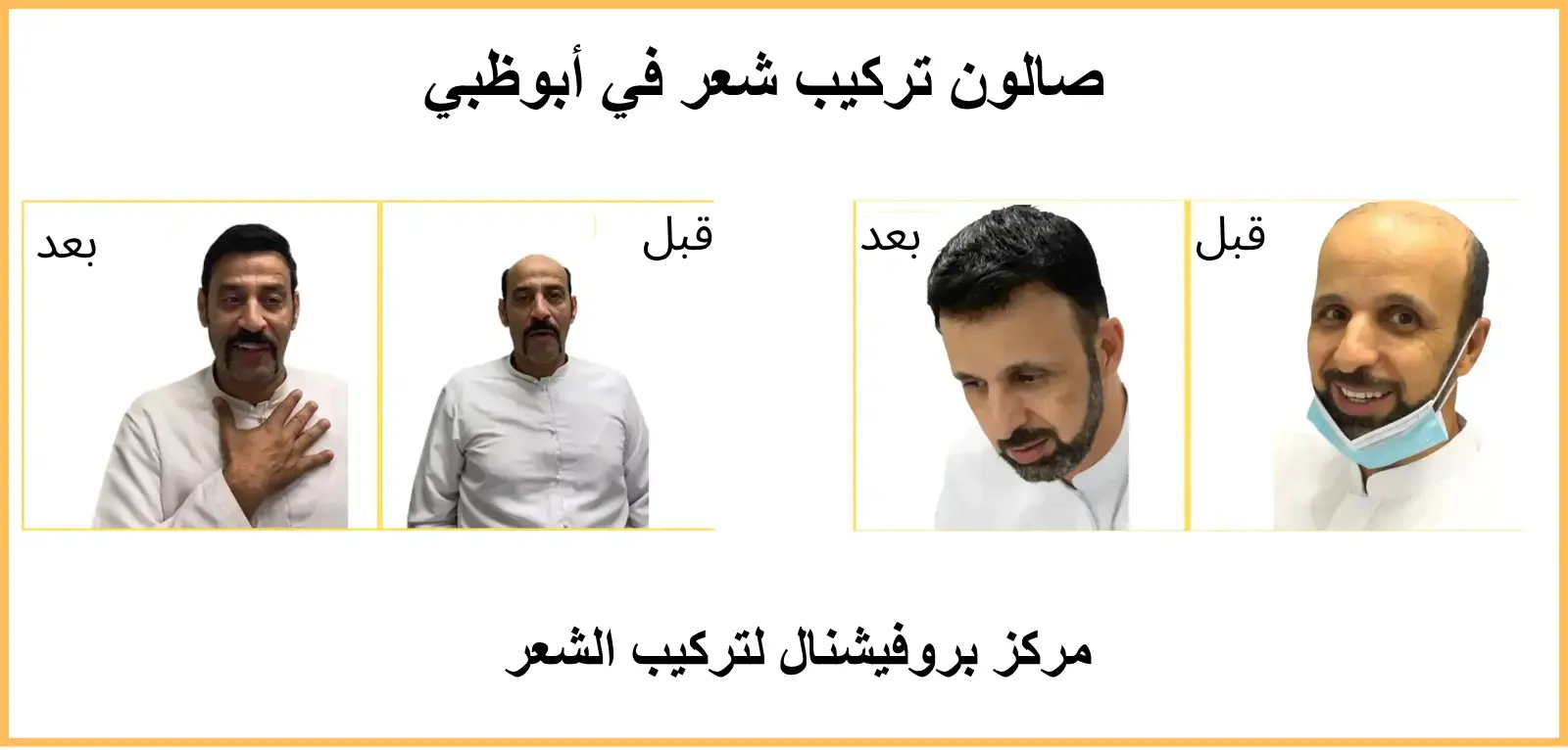 صالون تركيب شعر في أبوظبي