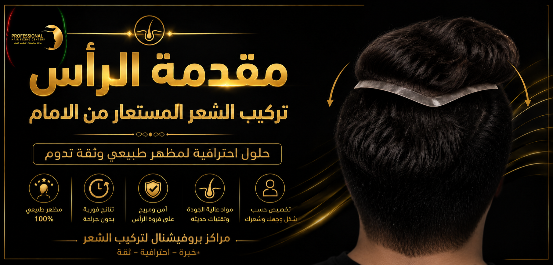 مقدمة الرأس تركيب الشعر المستعار من الامام
